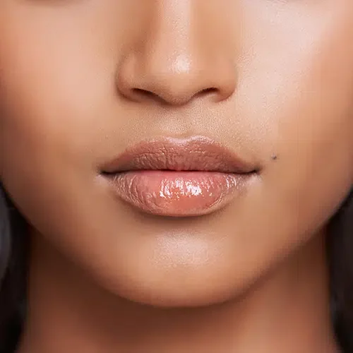 Maeli Clinic labios acido hialuronico alicante Clínica estética en Alicante, Medicina estética, tratamiento para labios con ácido hialurónico