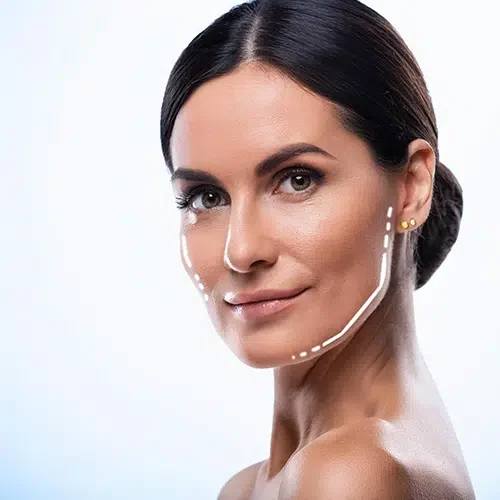 Maeli Clinic medicina estetica endolifting alicante Clínica estética en Alicante, Medicina estética, tratamiento endolifting