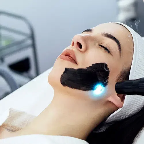 Clínica estética en Alicante, Medicina estética, tratamiento Hollywood Peel