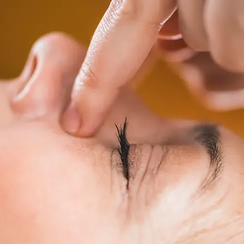 Clínica estética en Alicante, Maeli Clinic, Tratamiento blefaroplastia sin cirugía